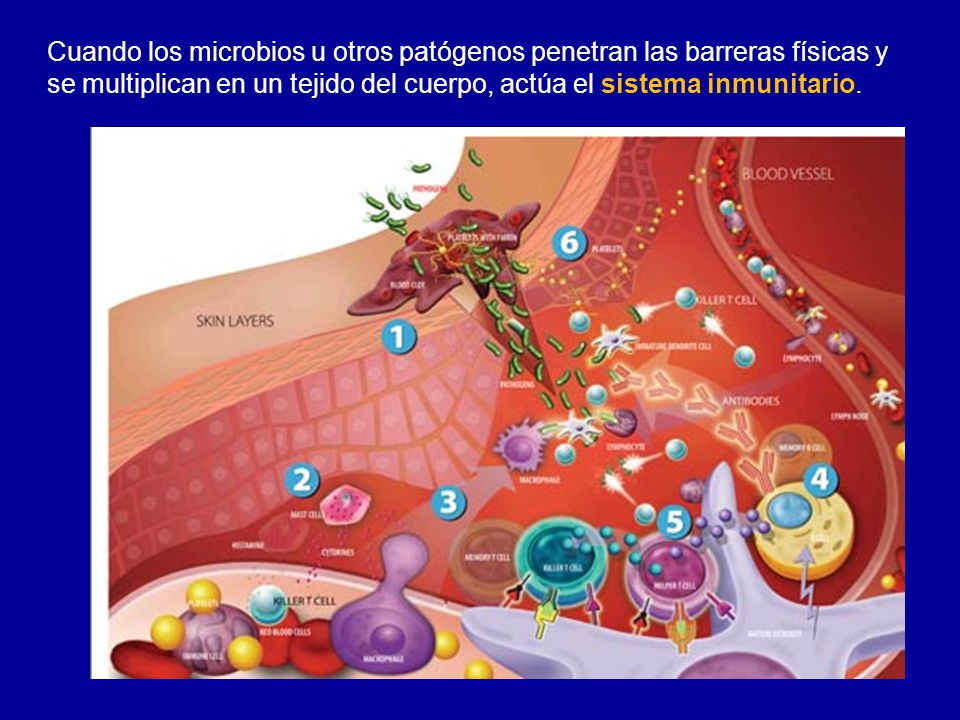 Cuando los microbios u otros patógenos penetran las barreras físicas y se multiplican en un tejido del cuerpo, actúa el sistema inmunitario.