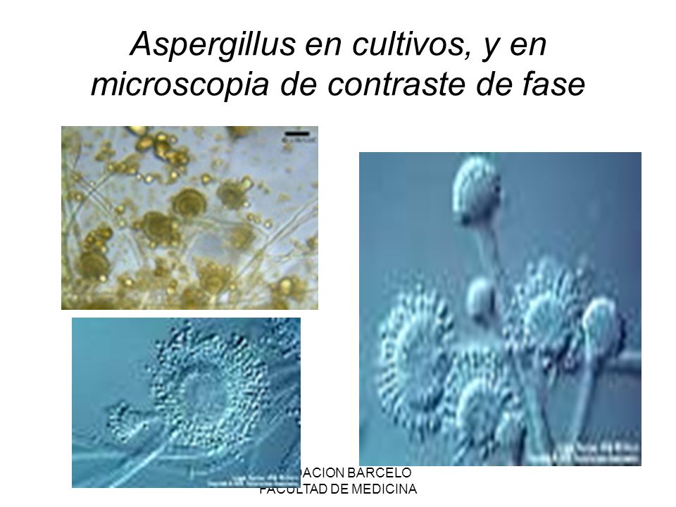 Aspergillus en cultivos, y en microscopia de contraste de fase