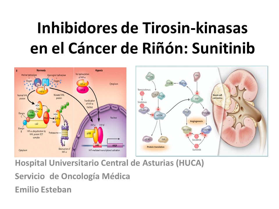 Inhibidores de Tirosin-kinasas en el Cáncer de Riñón: Sunitinib