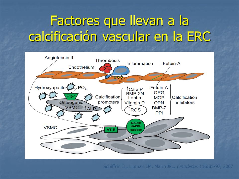 Factores que llevan a la calcificación vascular en la ERC