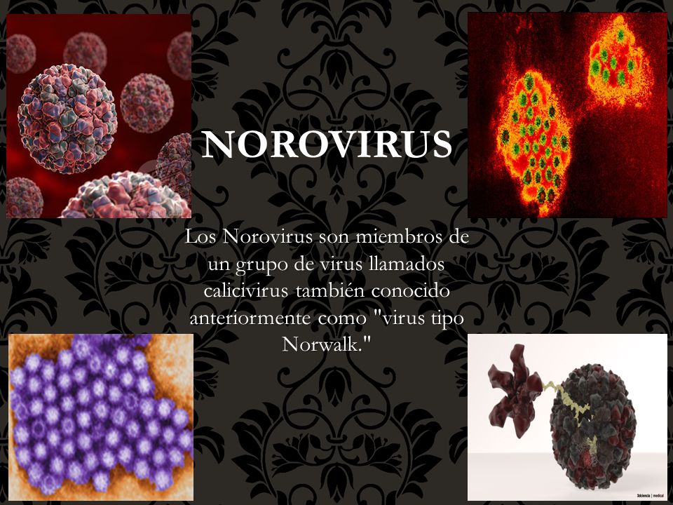 NOROVIRUS Los Norovirus son miembros de un grupo de virus llamados calicivirus también conocido anteriormente como virus tipo Norwalk.