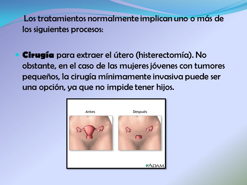 Los tratamientos normalmente implican uno o más de los siguientes procesos: