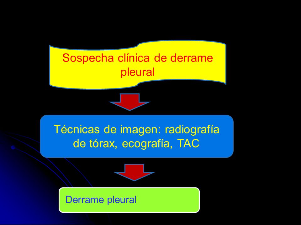 Sospecha clínica de derrame pleural