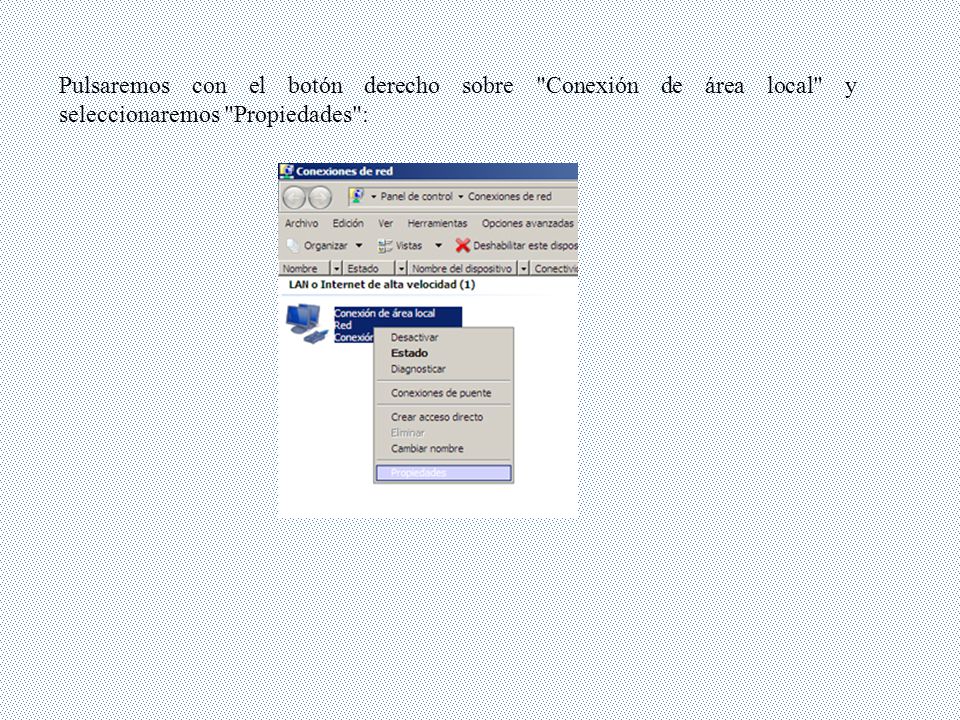 Pulsaremos con el botón derecho sobre Conexión de área local y seleccionaremos Propiedades :