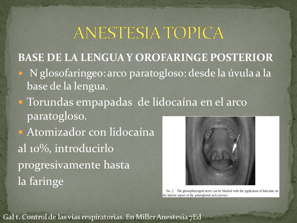 ANESTESIA TOPICA BASE DE LA LENGUA Y OROFARINGE POSTERIOR. N glosofaríngeo: arco paratogloso: desde la úvula a la base de la lengua.
