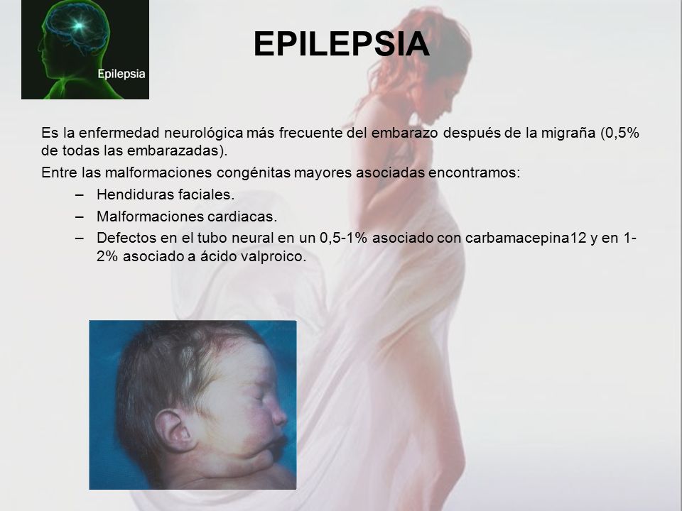 EPILEPSIA Es la enfermedad neurológica más frecuente del embarazo después de la migraña (0,5% de todas las embarazadas).