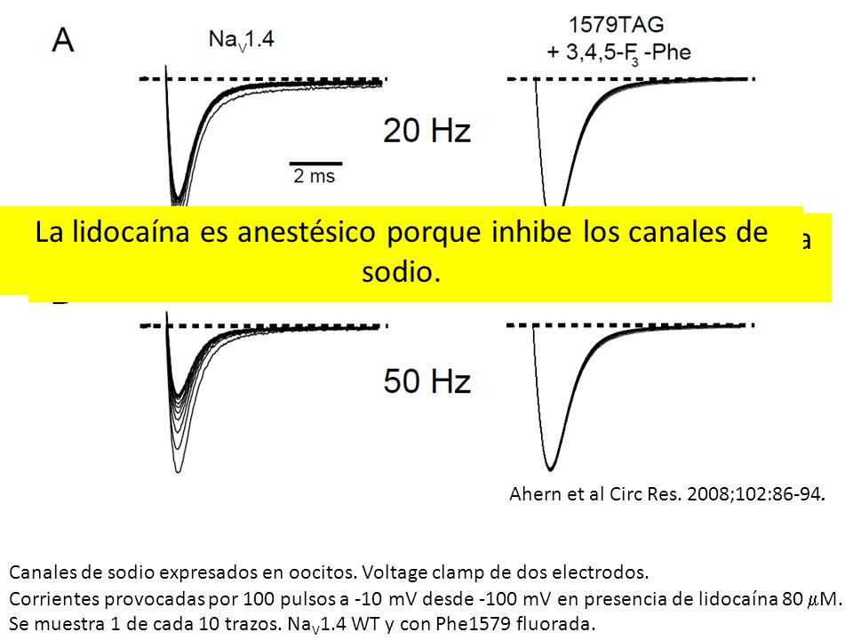 La lidocaína es anestésico porque inhibe los canales de sodio.