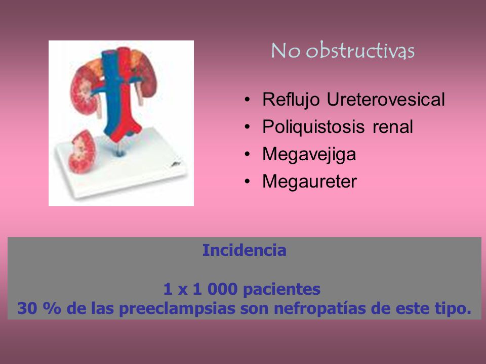 30 % de las preeclampsias son nefropatías de este tipo.