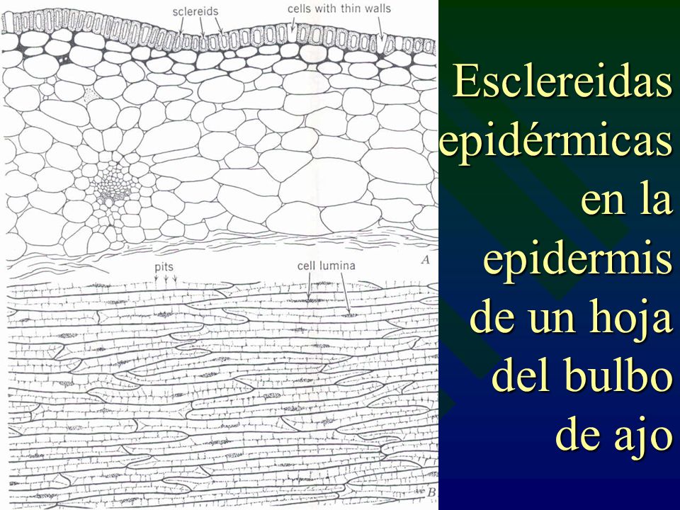 Esclereidas epidérmicas en la epidermis de un hoja del bulbo de ajo