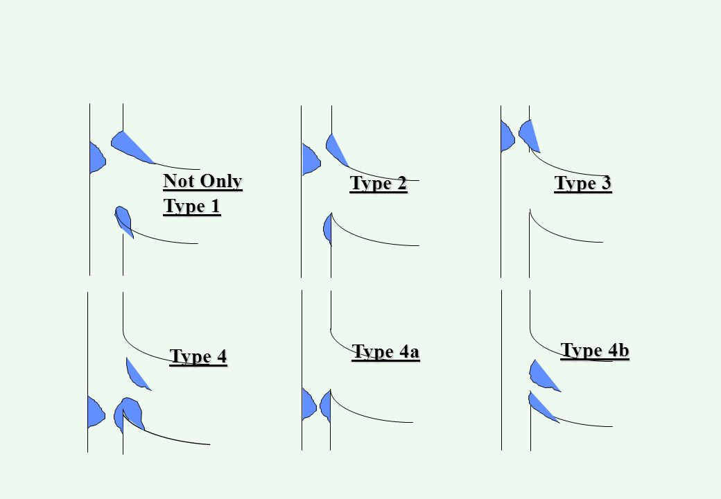 Not Only Type 1 Type 2 Type 3 Type 4 Type 4b Type 4a