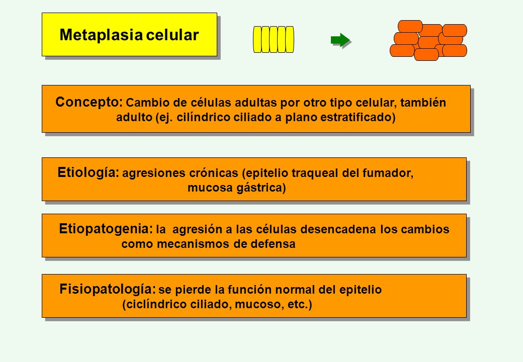 Metaplasia celular Concepto: Cambio de células adultas por otro tipo celular, también. adulto (ej. cilíndrico ciliado a plano estratificado)