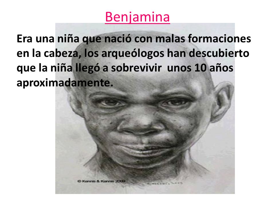 Benjamina : era una niña que nació con malformaciones, los arqueologos han dicho qu Benjamina