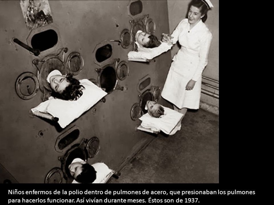 Niños enfermos de la polio dentro de pulmones de acero, que presionaban los pulmones para hacerlos funcionar.