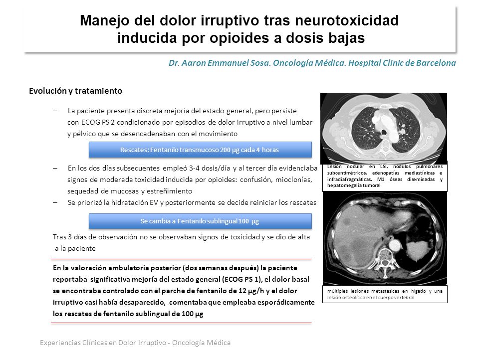 Manejo del dolor irruptivo tras neurotoxicidad inducida por opioides a dosis bajas