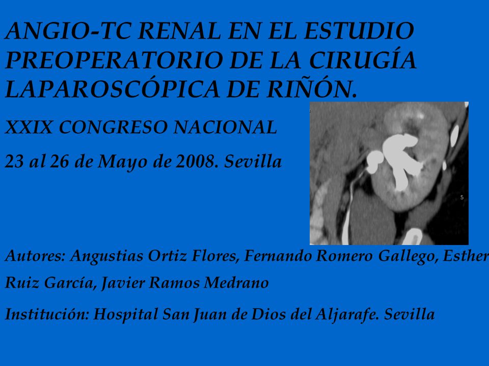 ANGIO-TC RENAL EN EL ESTUDIO PREOPERATORIO DE LA CIRUGÍA LAPAROSCÓPICA DE RIÑÓN.