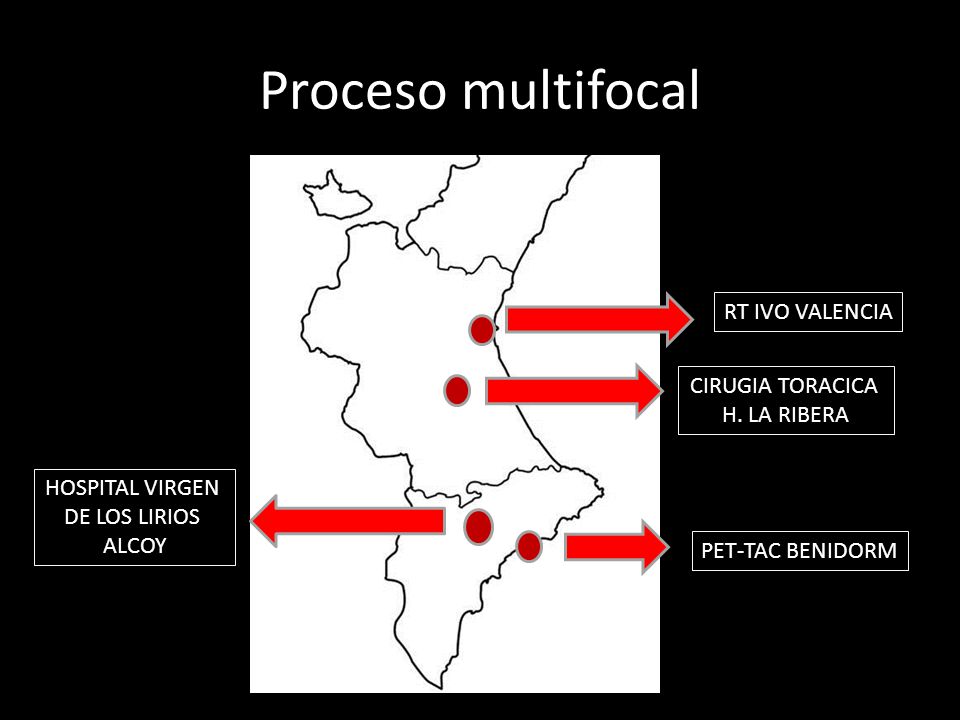 Proceso multifocal RT IVO VALENCIA CIRUGIA TORACICA H. LA RIBERA