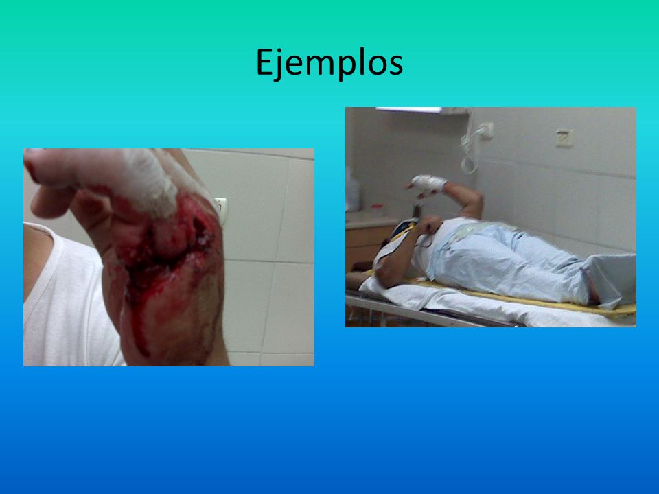 Ejemplos Alejandro ponga fotos accidentes de tránsito reales o de emergencias
