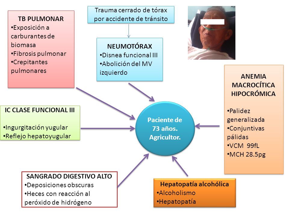 Trauma cerrado de tórax por accidente de tránsito TB PULMONAR