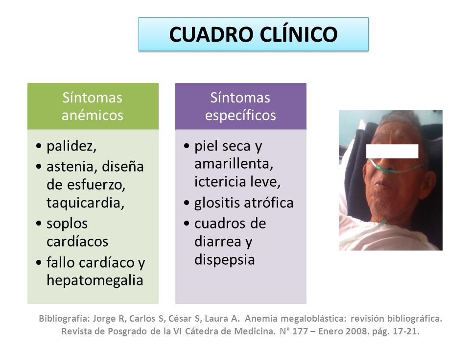 CUADRO CLÍNICO Síntomas anémicos. palidez, astenia, diseña de esfuerzo, taquicardia, soplos cardíacos.