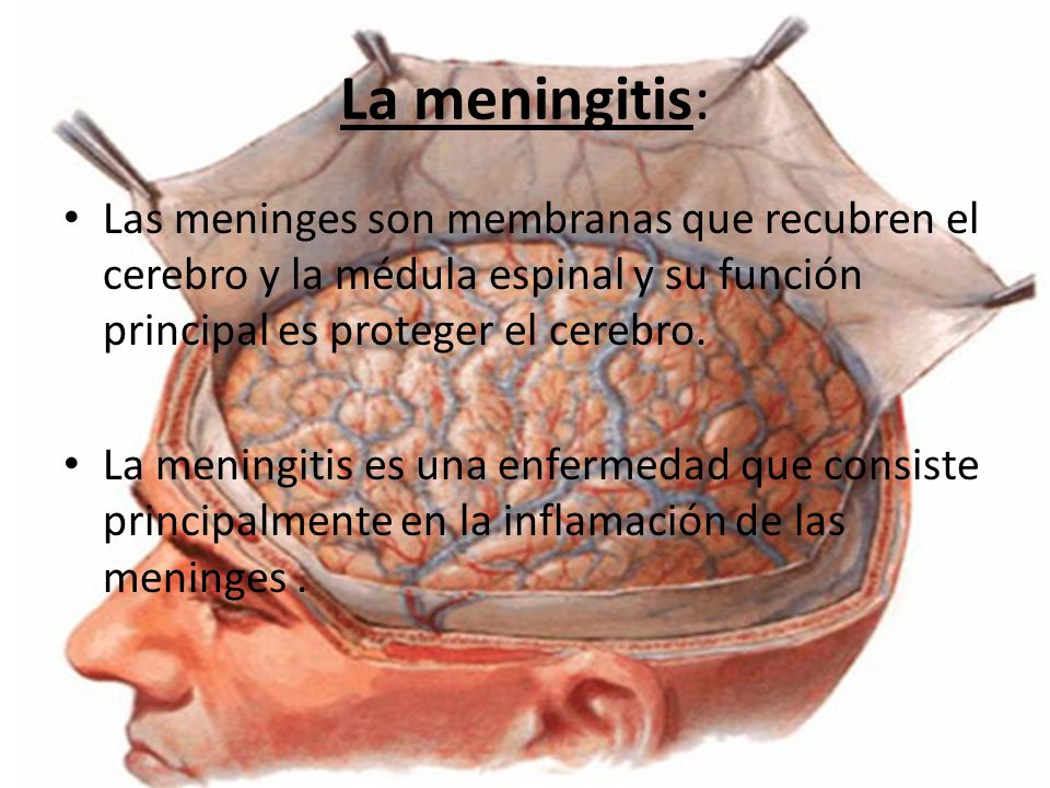 La meningitis: Las meninges son membranas que recubren el cerebro y la médula espinal y su función principal es proteger el cerebro.