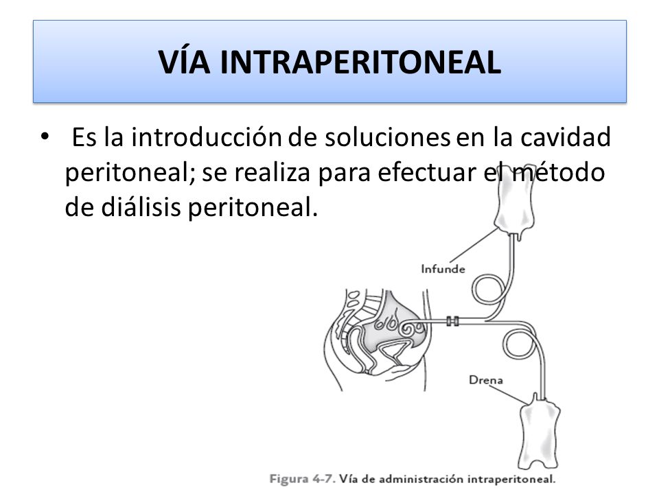VÍA INTRAPERITONEAL Es la introducción de soluciones en la cavidad peritoneal; se realiza para efectuar el método de diálisis peritoneal.