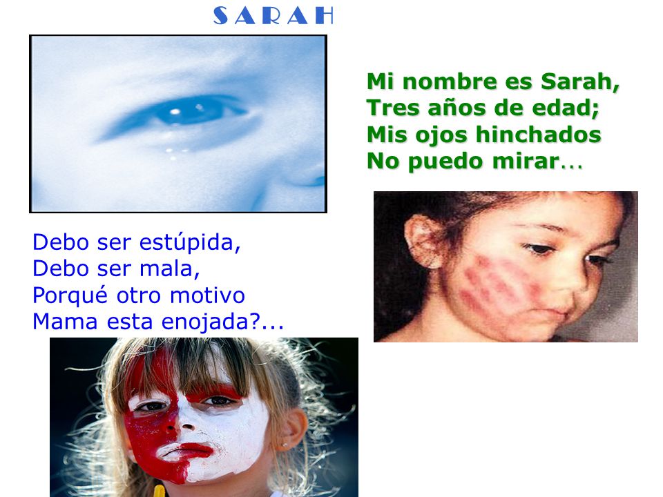 S A R A H Mi nombre es Sarah, Tres años de edad; Mis ojos hinchados No puedo mirar...