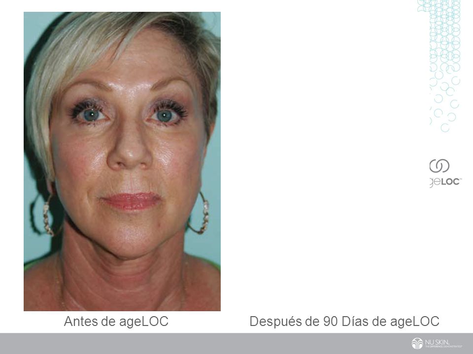 Antes de ageLOC Después de 90 Días de ageLOC After 60 Days of ageLOC