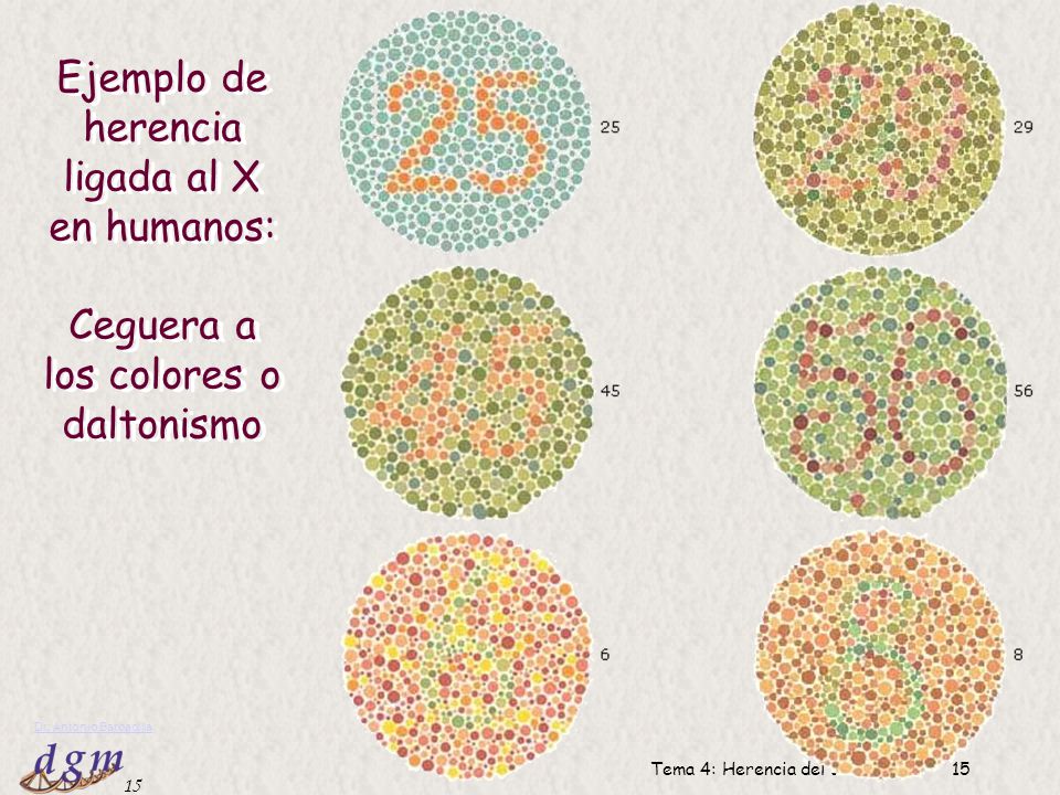 Ejemplo de herencia ligada al X en humanos: