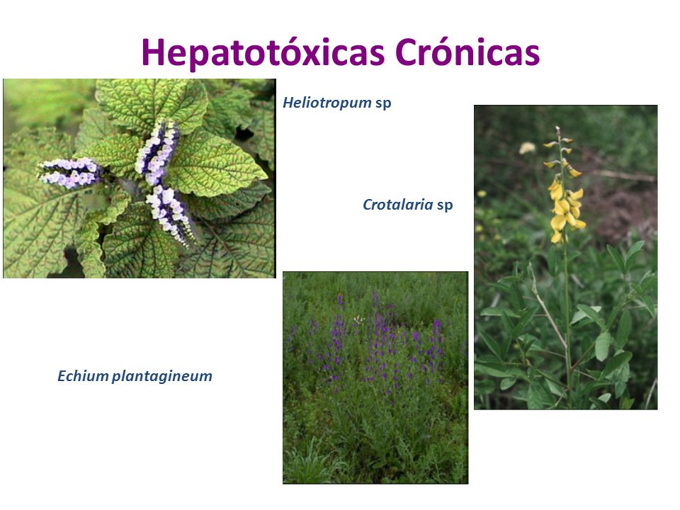 Hepatotóxicas Crónicas