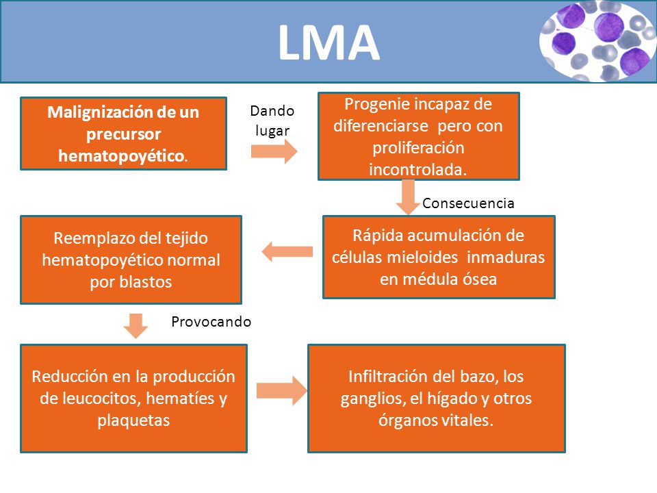 LMA Progenie incapaz de diferenciarse pero con proliferación incontrolada. Malignización de un precursor hematopoyético.