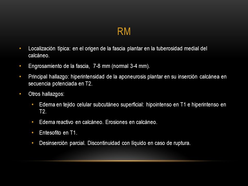 RM Localización típica: en el origen de la fascia plantar en la tuberosidad medial del calcáneo.
