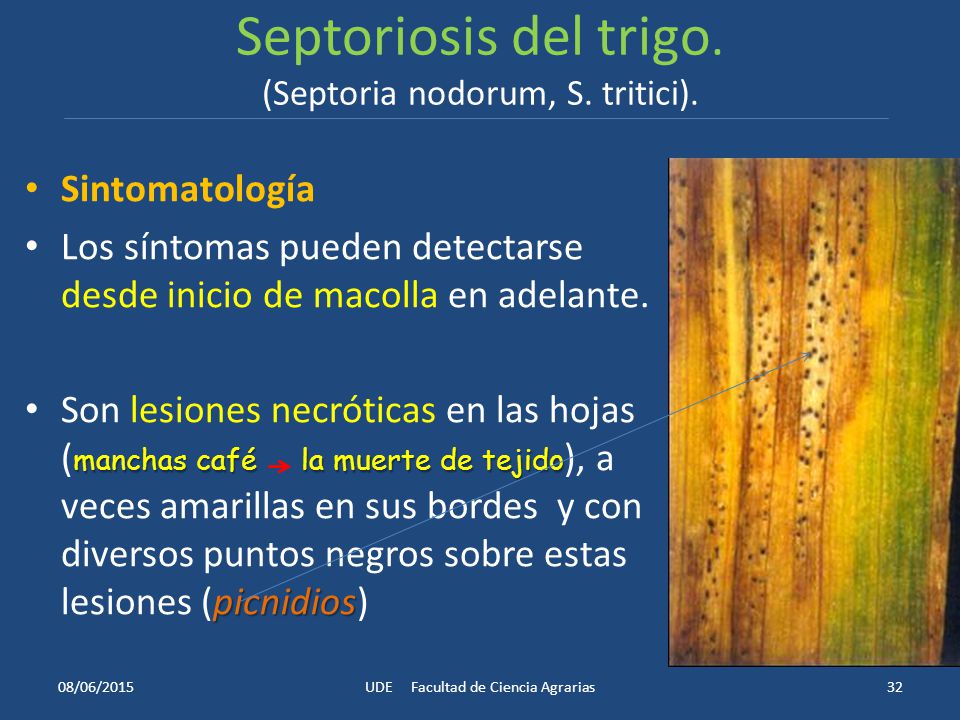 Septoriosis del trigo. (Septoria nodorum, S. tritici).