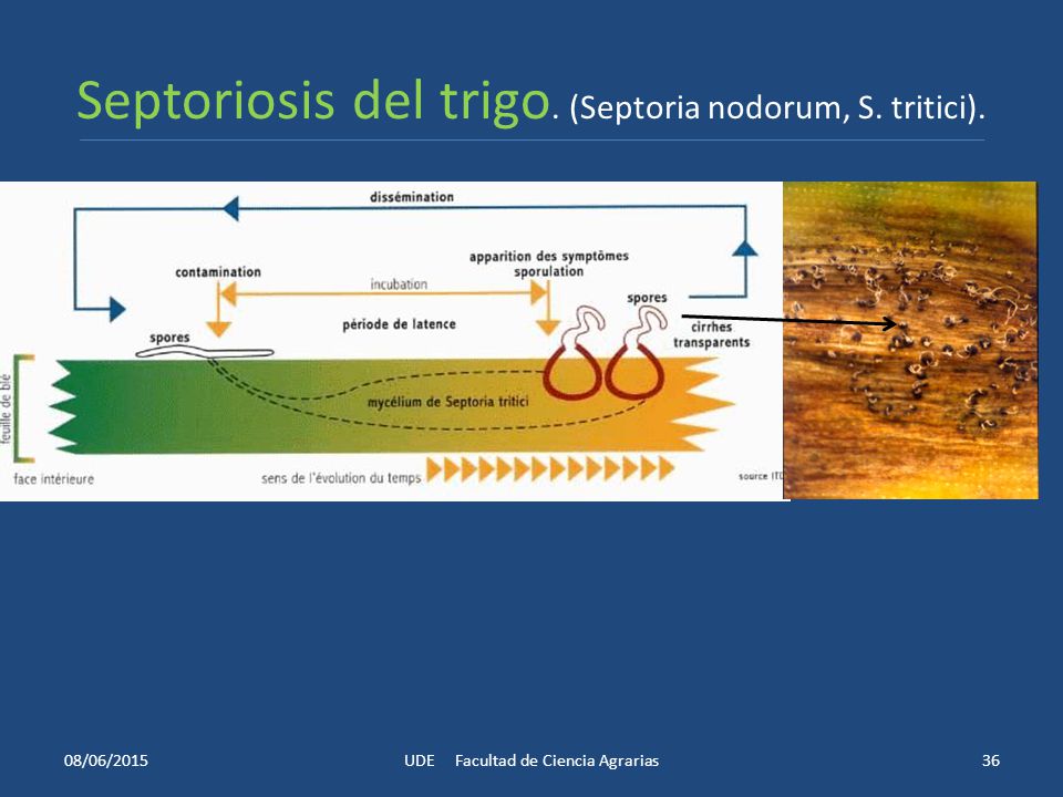 Septoriosis del trigo. (Septoria nodorum, S. tritici).