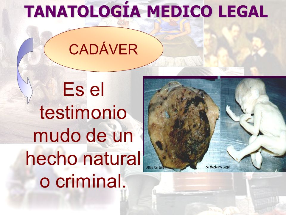 Es el testimonio mudo de un hecho natural o criminal.