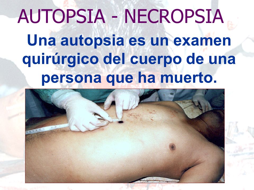 AUTOPSIA - NECROPSIA Una autopsia es un examen quirúrgico del cuerpo de una persona que ha muerto.