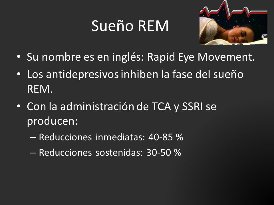 Sueño REM Su nombre es en inglés: Rapid Eye Movement.