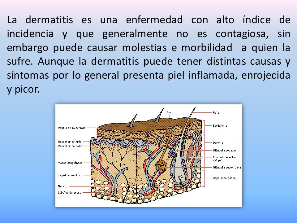 La dermatitis es una enfermedad con alto índice de incidencia y que generalmente no es contagiosa, sin embargo puede causar molestias e morbilidad a quien la sufre.