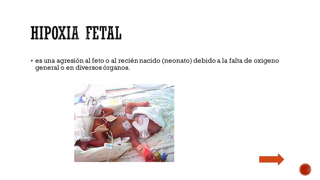 Hipoxia fetal es una agresión al feto o al recién nacido (neonato) debido a la falta de oxigeno general o en diversos órganos.