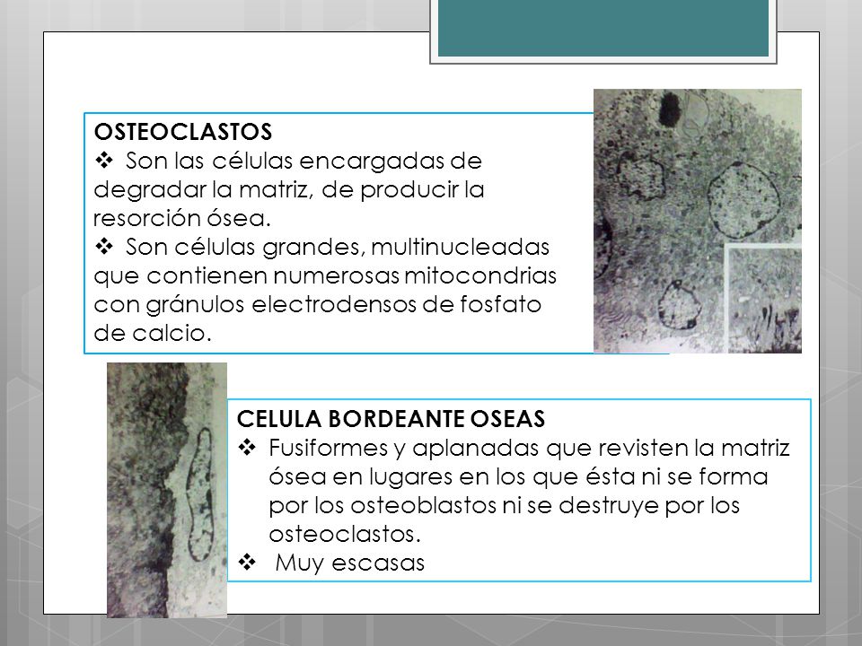 OSTEOCLASTOS Son las células encargadas de. degradar la matriz, de producir la. resorción ósea. Son células grandes, multinucleadas.