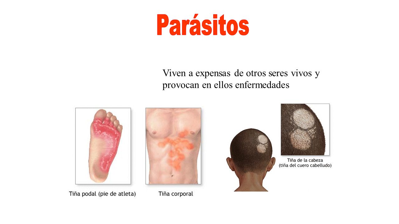 Parásitos Viven a expensas de otros seres vivos y provocan en ellos enfermedades
