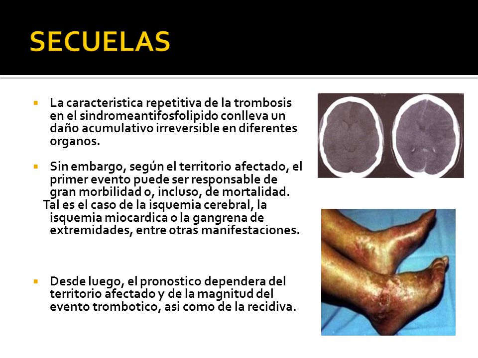 SECUELAS La caracteristica repetitiva de la trombosis en el sindromeantifosfolipido conlleva un daño acumulativo irreversible en diferentes organos.