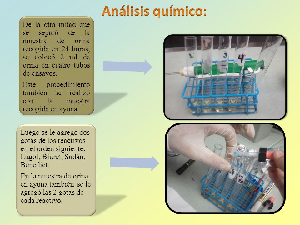 Análisis químico: De la otra mitad que se separó de la muestra de orina recogida en 24 horas, se colocó 2 ml de orina en cuatro tubos de ensayos.