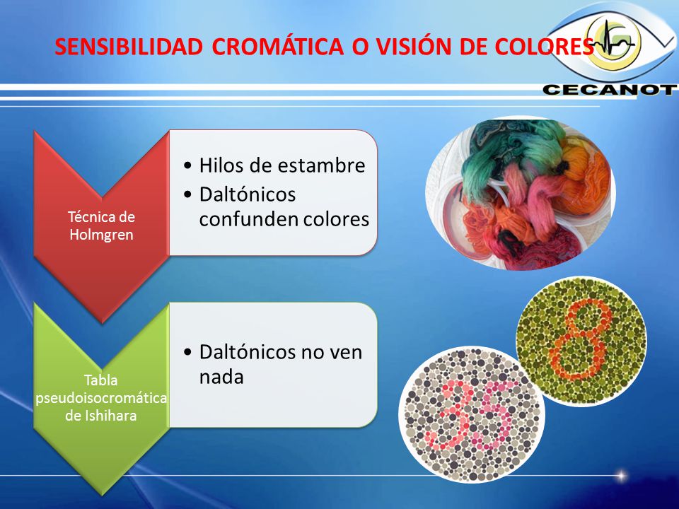 SENSIBILIDAD CROMÁTICA O VISIÓN DE COLORES