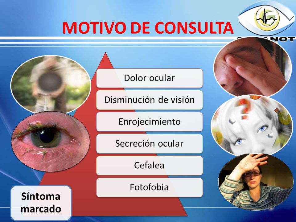 MOTIVO DE CONSULTA Síntoma marcado Dolor ocular Disminución de visión