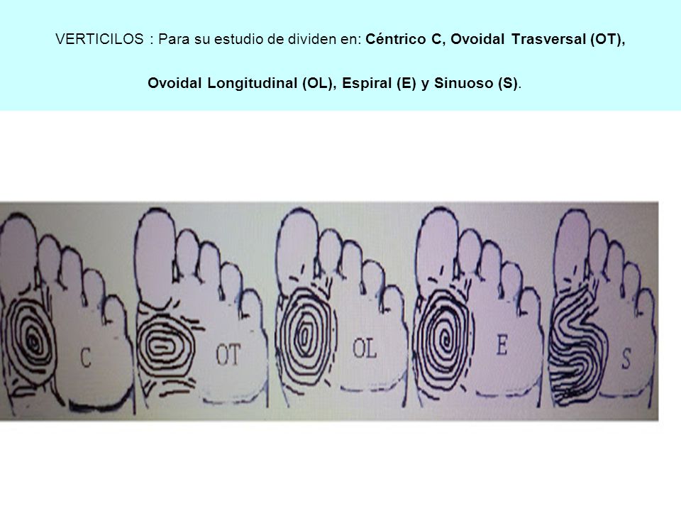 VERTICILOS : Para su estudio de dividen en: Céntrico C, Ovoidal Trasversal (OT), Ovoidal Longitudinal (OL), Espiral (E) y Sinuoso (S).