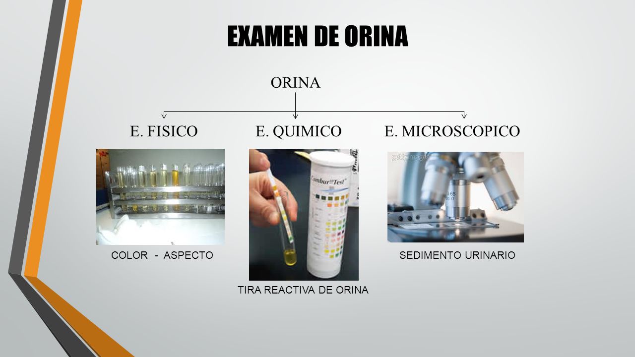 EXAMEN DE ORINA ORINA E. FISICO E. QUIMICO E. MICROSCOPICO