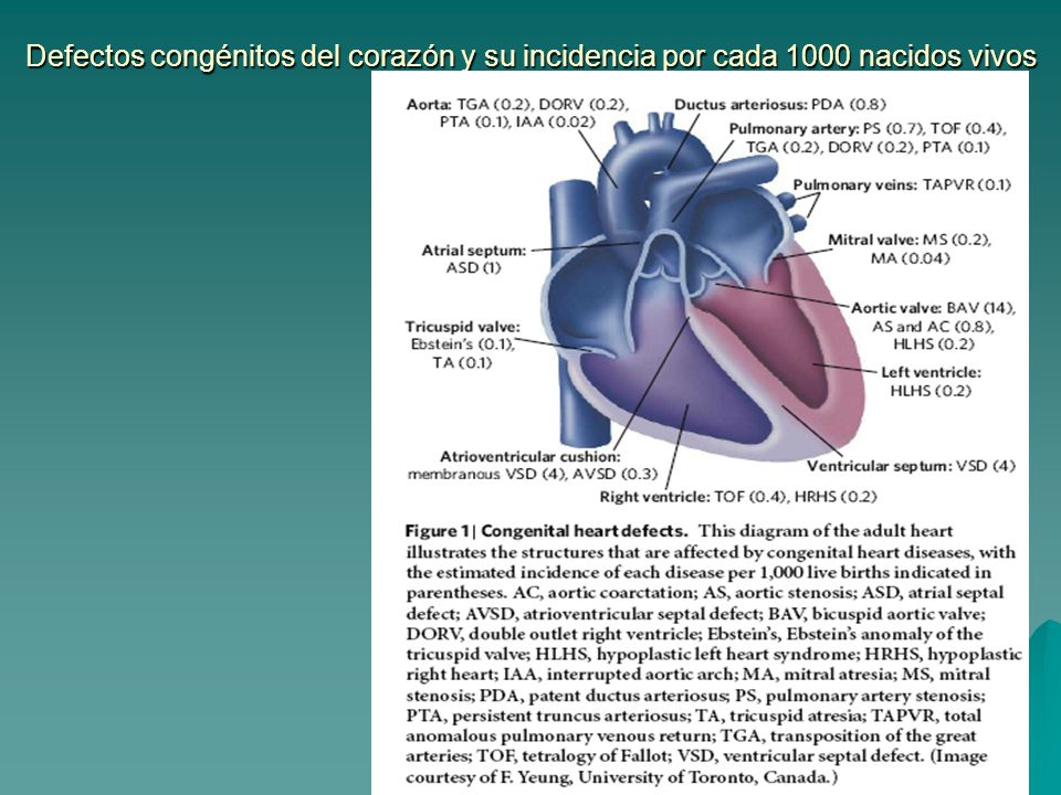 Defectos congénitos del corazón y su incidencia por cada 1000 nacidos vivos