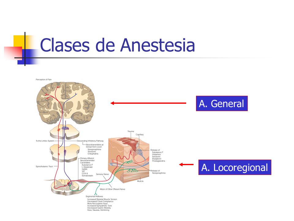 Clases de Anestesia A. General A. Locoregional