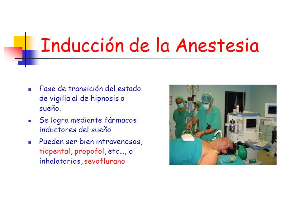 Inducción de la Anestesia