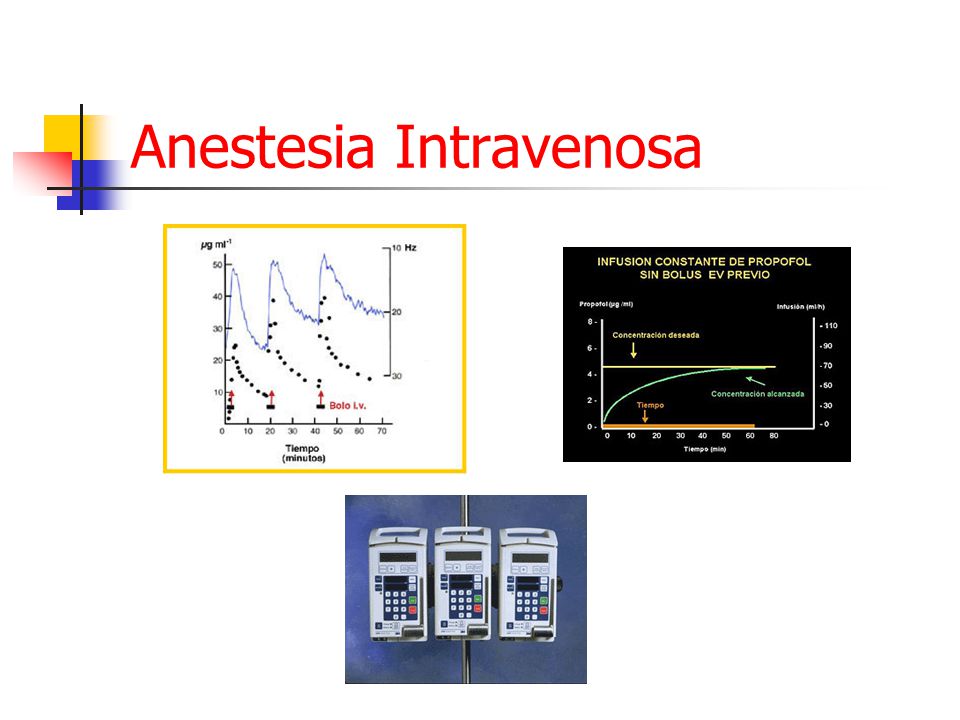 Anestesia Intravenosa